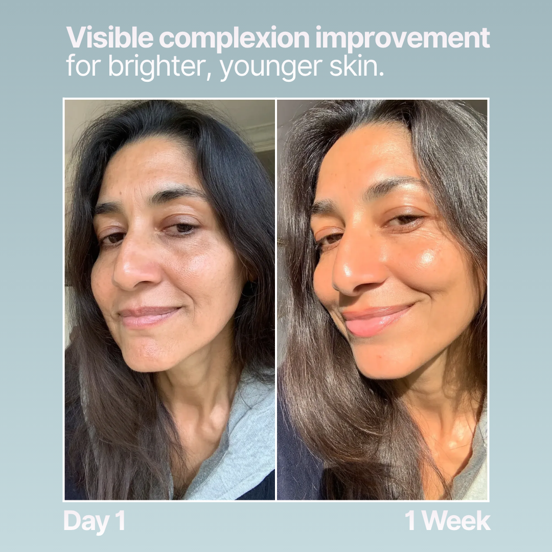 Mesotox Skin Booster PDRN