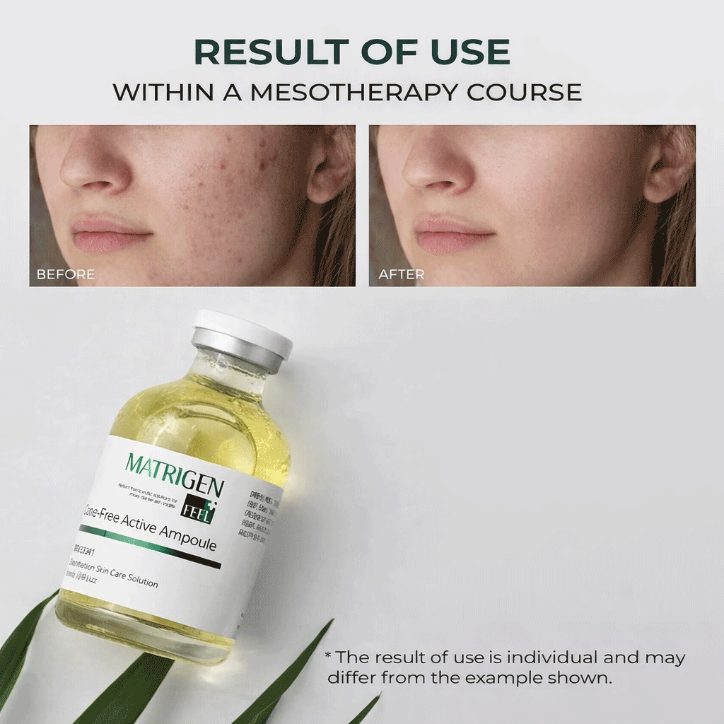 Matrigen ESR Acne Free Solution