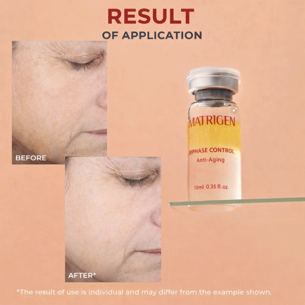 Matrigen Bi Phase Anti-Aging Ampoule