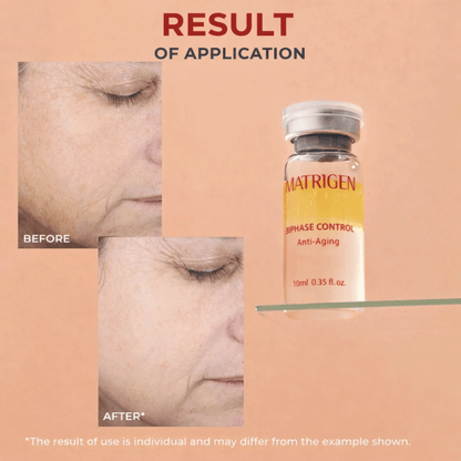 Matrigen Bi Phase Anti-Aging Ampoule