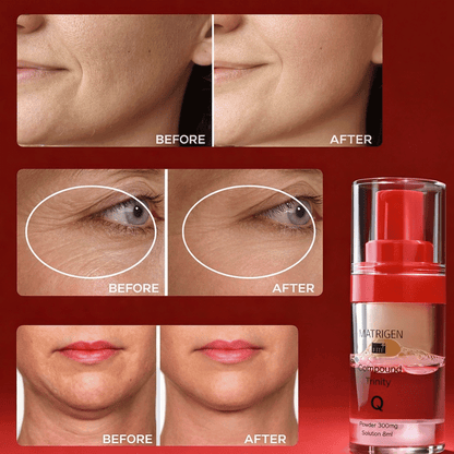 Matrigen Compound Trinity Q