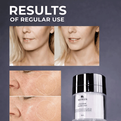 Matrigen LipoExosome Absolute Cream