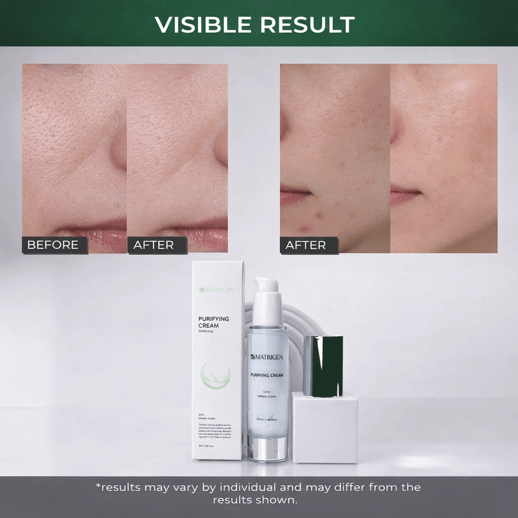 Matrigen Purifying Cream 50ml.