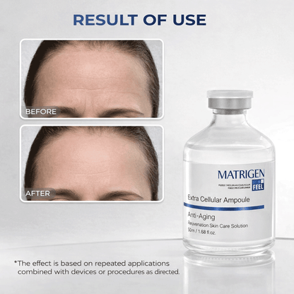 Matrigen ESR Hydra Cellular Ampoule