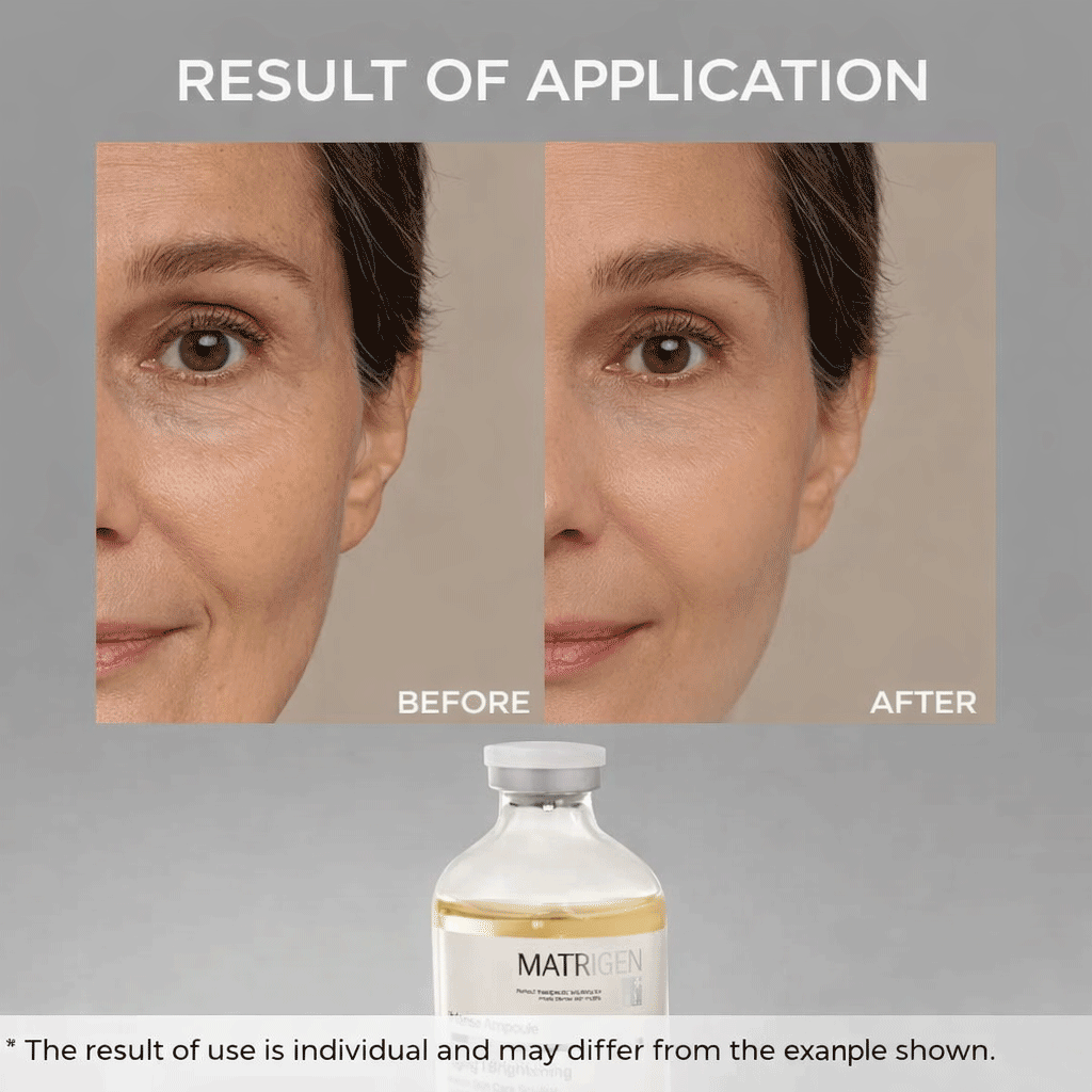 Matrigen ESR Vital Intense Ampoule