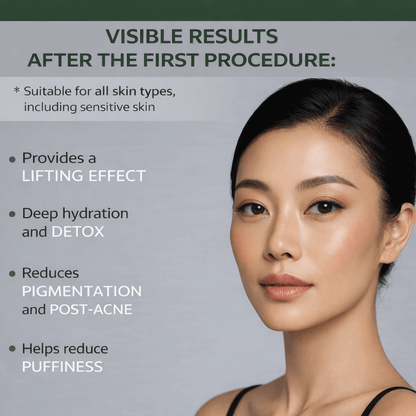 Matrigen CO2 Snow Carboxy Therapy