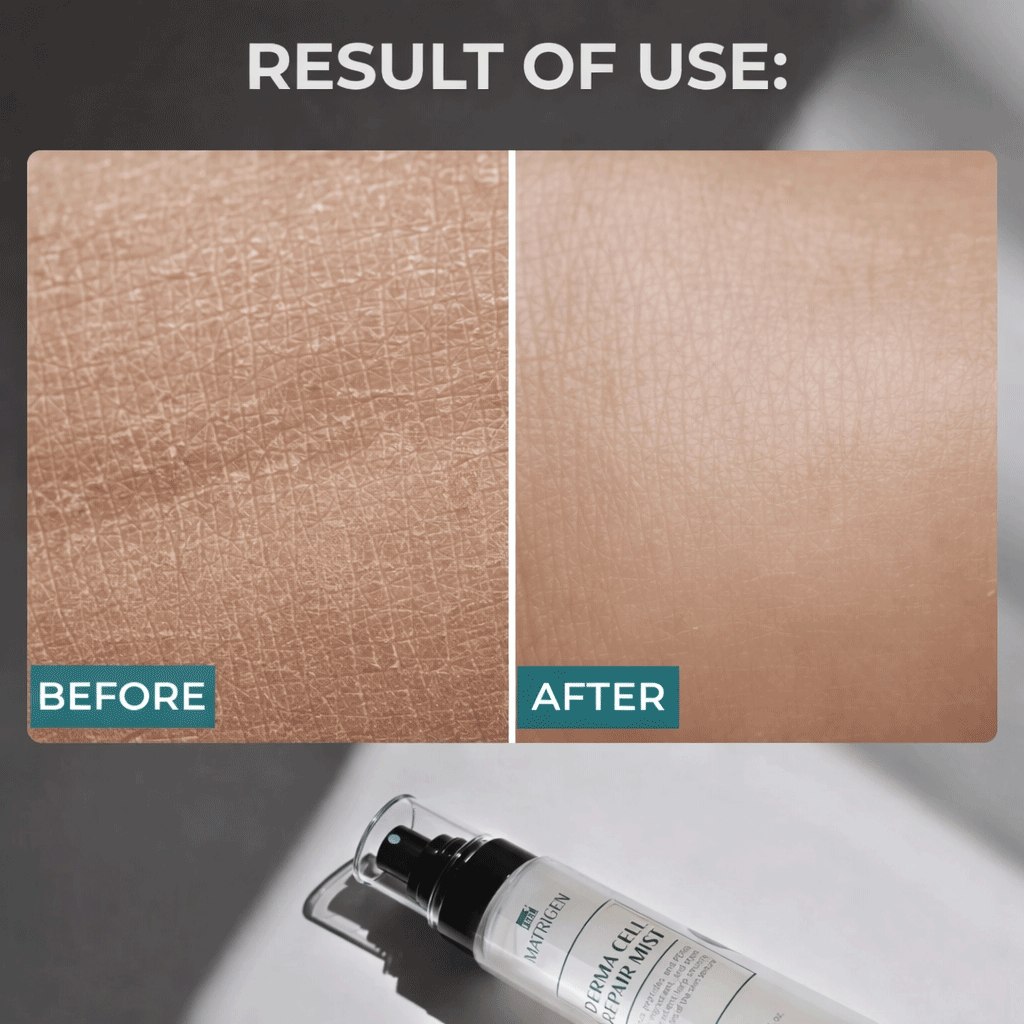 Matrigen Derma Cell Repair Mist