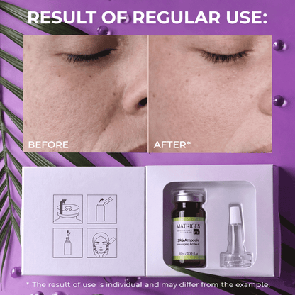 Matrigen SRS Anti-Aging Ampoule